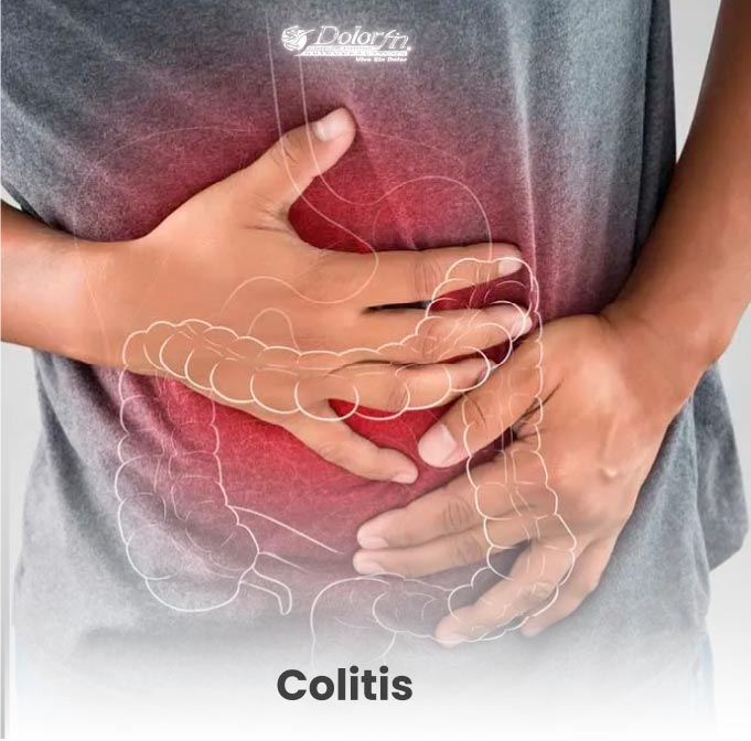 quiropractico-monterrey-cita-colitis